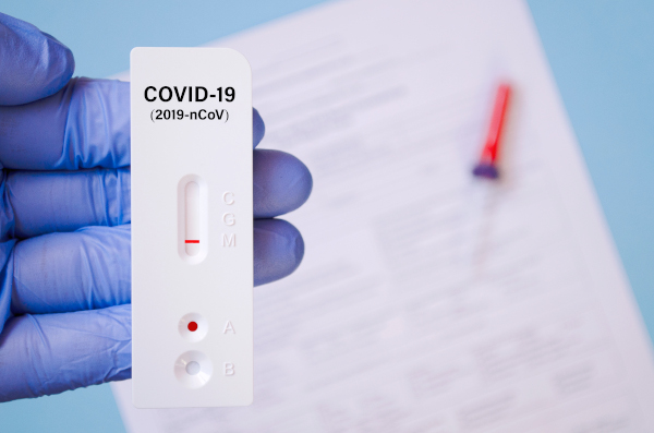Teste de COVID-19: Tudo o que você precisa saber – Blog do
